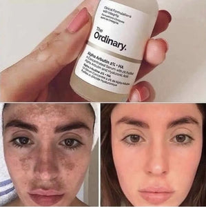 alpha arbutin 2% ha (restaure léclat)